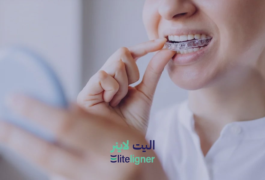 ارتودنسی با الاینر شفاف در کرمان