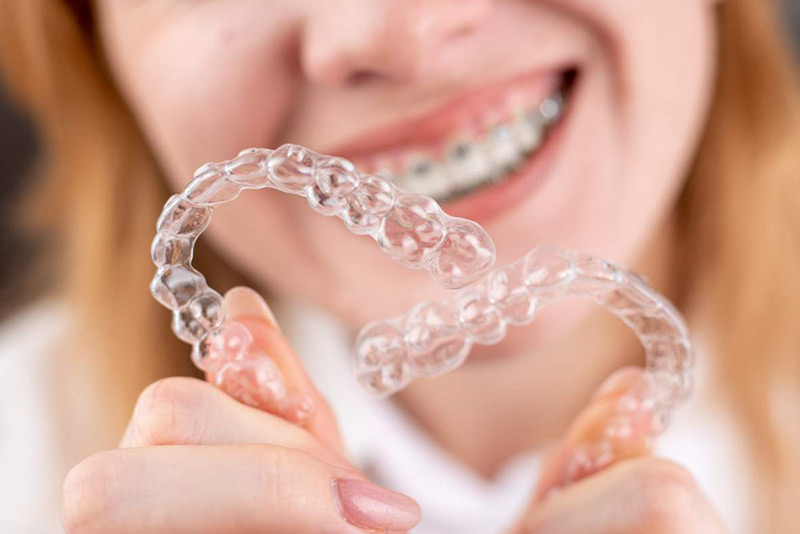 ارتودنسی نامرئی متحرک چیست؟